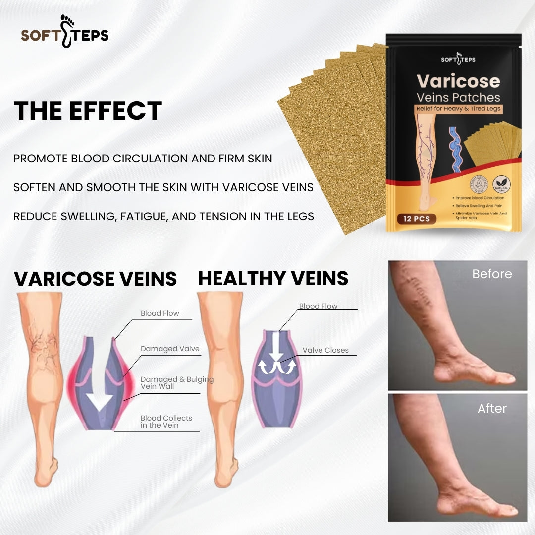 Varicose Veins Patches – Natural Relief for Swelling, Pain & Circulation Support
