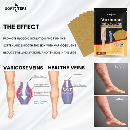 Varicose Veins Patches – Natural Relief for Swelling, Pain & Circulation Support