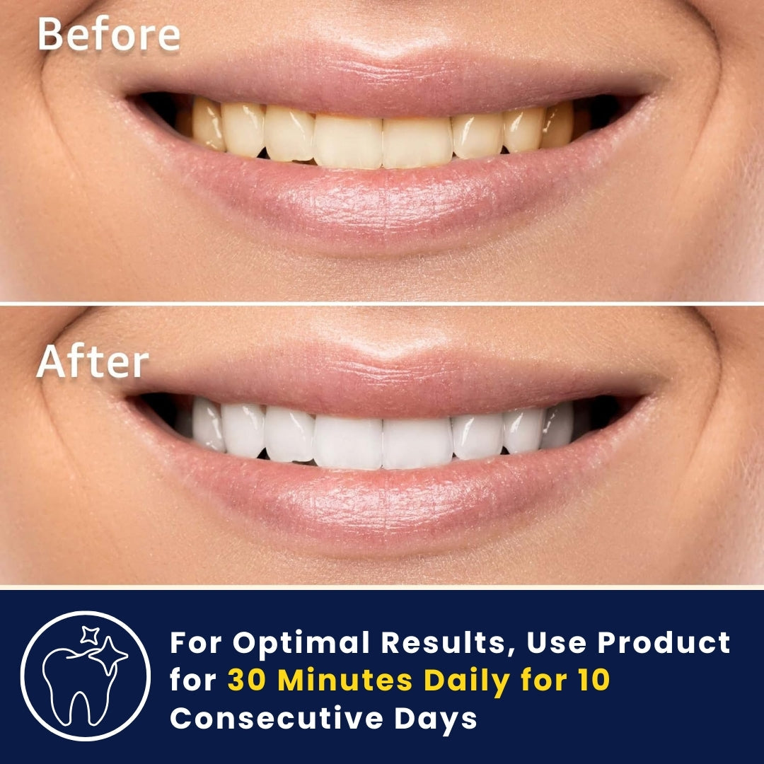 3D Teeth Whitening Strips