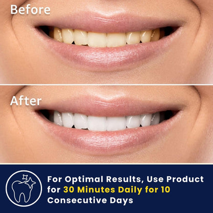 3D Teeth Whitening Strips