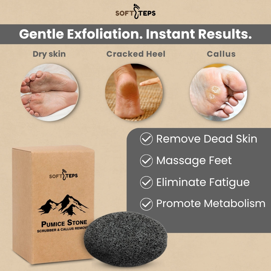 Natural Heel & Body Pumice Stone – Best Exfoliator Tool