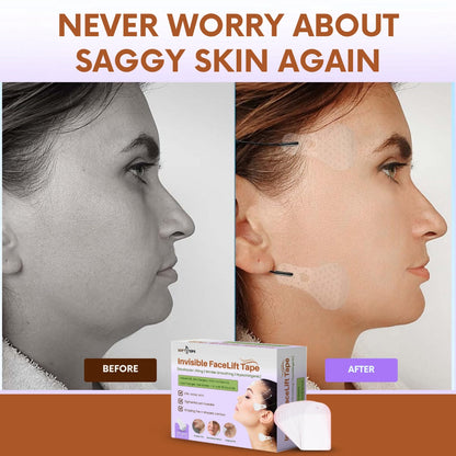 Invisible FaceLift Tape