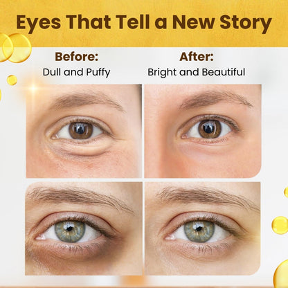 Hydrating Under-Eye Gel Patches